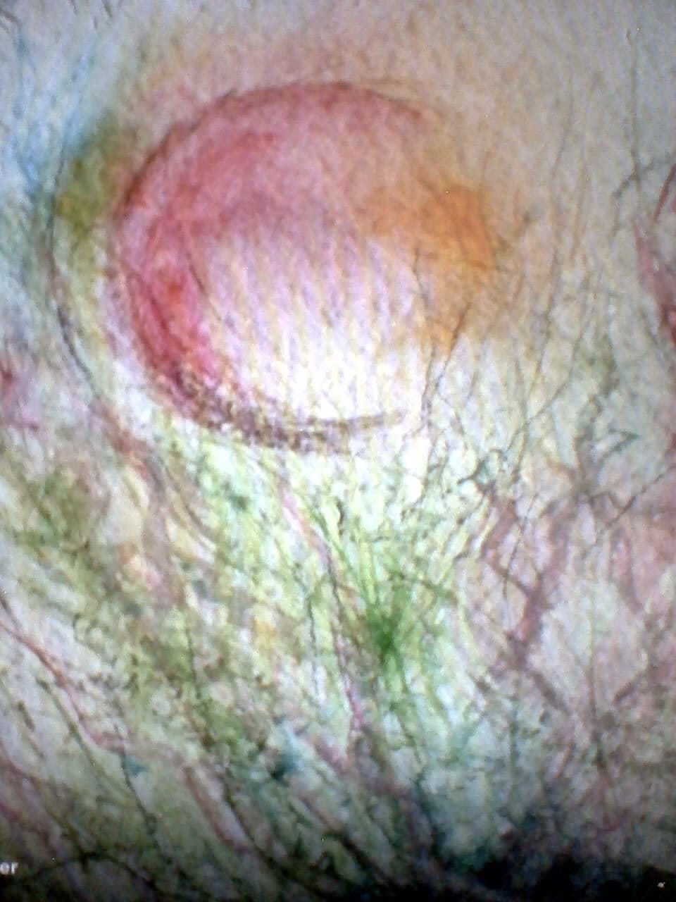 a painting of a man's stomach